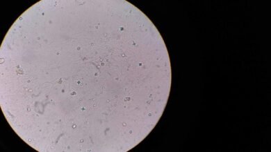 caller risk analysis report